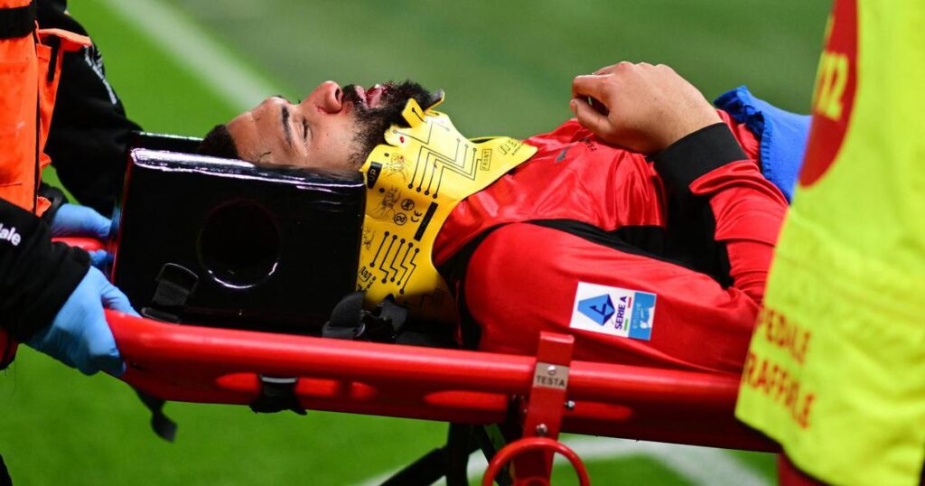 Modrićev suigrač sa slomljenom čeljusti iznesen s utakmice: Sad je objavio kako mu izgleda lice Modrićev suigrač sa slomljenom čeljusti iznesen s utakmice: Sad je objavio kako mu izgleda lice