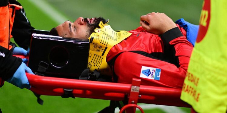 Modrićev suigrač sa slomljenom čeljusti iznesen s utakmice: Sad je objavio kako mu izgleda lice Modrićev suigrač sa slomljenom čeljusti iznesen s utakmice: Sad je objavio kako mu izgleda lice